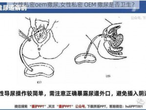 女性私密oem撒尿,女性私密 OEM 撒尿是否卫生？