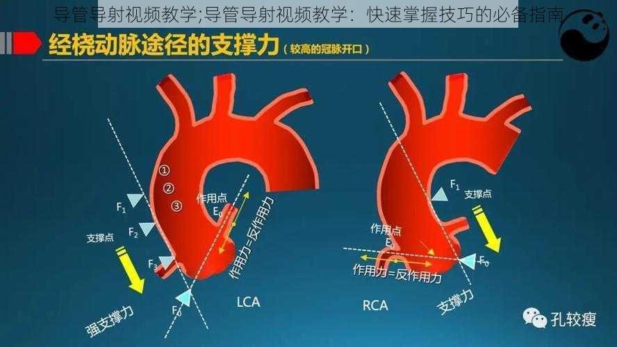 导管导射视频教学;导管导射视频教学：快速掌握技巧的必备指南