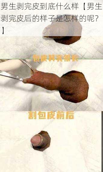 男生剥完皮到底什么样【男生剥完皮后的样子是怎样的呢？】